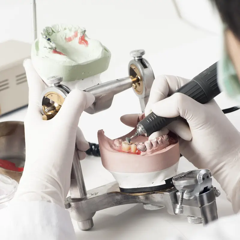 Denture models on an articulator in the Chrome Cast Dental Laboratory