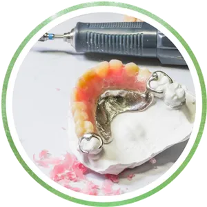 Additions, Adjustments and Repairs Chrome Cast Dental Laboratory