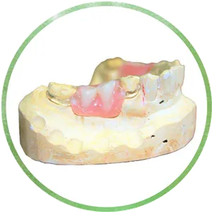 Clear Clasps Chrome Cast Dental Laboratory